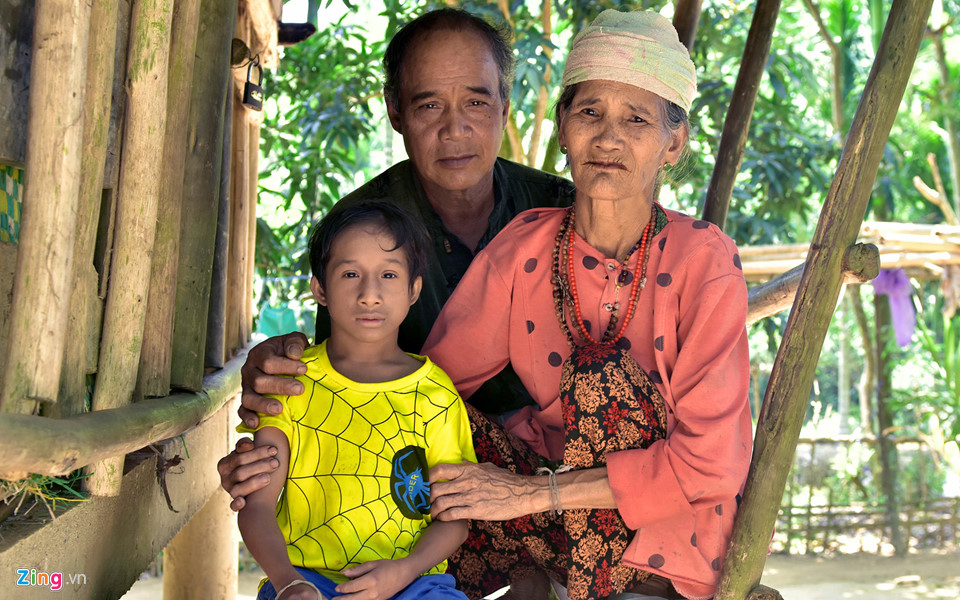 Nghị lực phi thường của cậu bé tý hon ở Quảng Ngãi